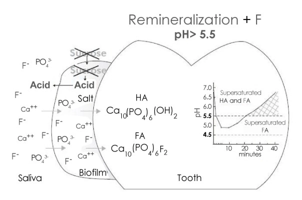 Remineralization by Fluoride (In dental Biofilm)