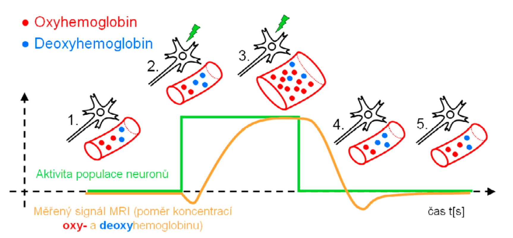 Schéma časového záznamu aktivace neuronu, změn prokrvení (perfuze) v jeho blízkosti, změn poměrů koncentrací
oxy- a deoxyhemoglobinu a odpovídajících změn měřeného signálu pomocí MR