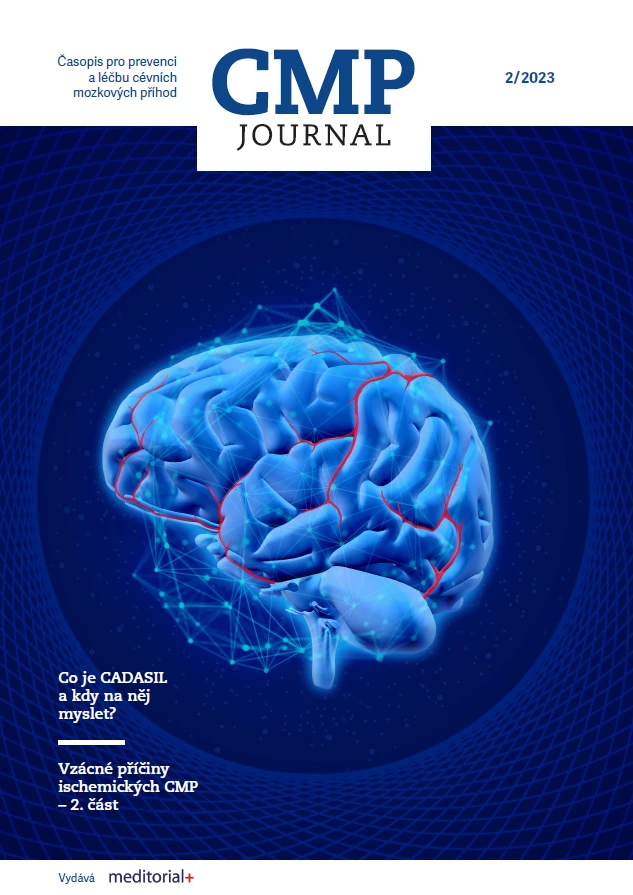 CMP journal